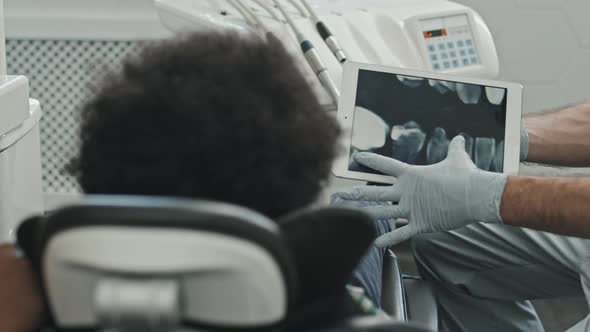 Doctor Showing Dental X-ray to Patient