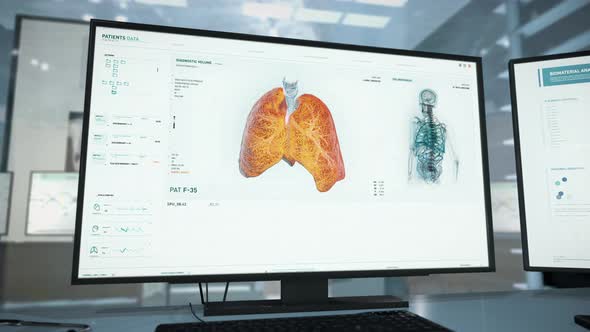 Scientific Research Of Lungs Appearance To Analyze Virus In Computer Program alt