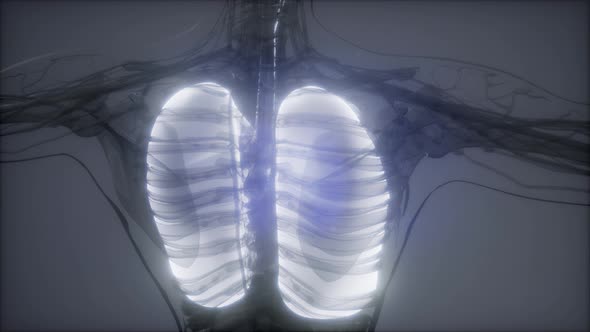 Human Lungs Radiology Exam alt