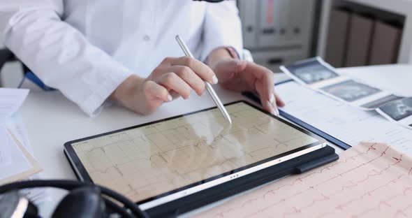 A Cardiologist Examines a Cardiogram on a Tablet Screen