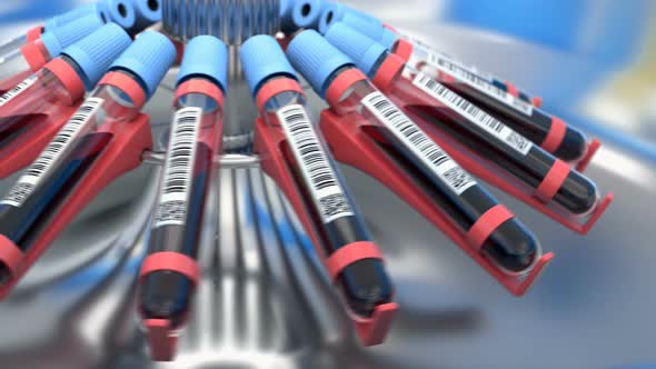 Plasmapheresis Proccess in the Lab Centrifuge