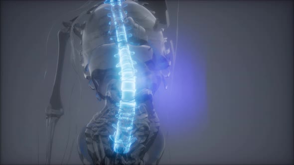 Backache in Back Bones alt