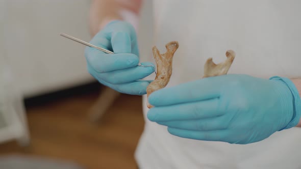 The dentist holds a human jaw in his hands and demonstrates dental problems