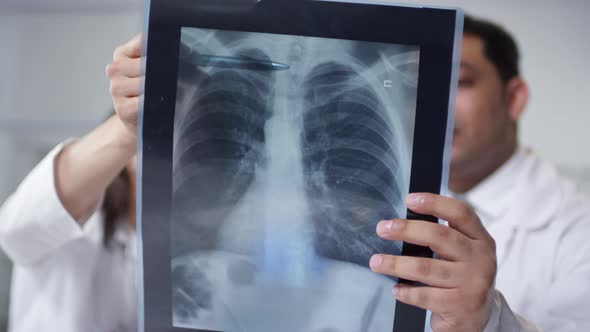 Sequence of Doctors Looking At Lungs X-Ray