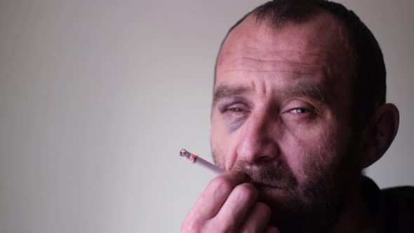 A Drunk Man Smokes a Cigarette with a Blue Hematoma Under His Eye