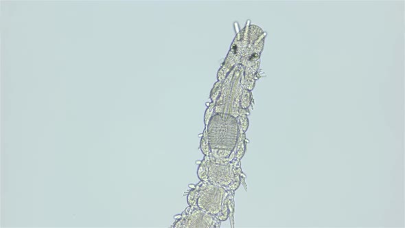 Worm Family Syllidae Under a Microscope Polychaeta Class Exogoninae Subfamily Possibly Genus Exogone