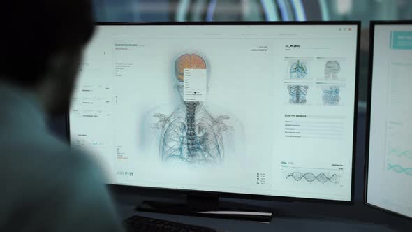 Medical Ultrasound Scanner For Brain Illness Examination At Modern Hospital alt