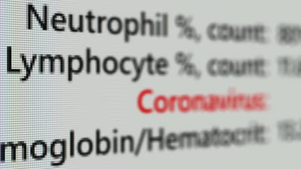 Coronavirus Covid-19 Test with Negative Result on the White Screen Page. Pandemic Corona Virus