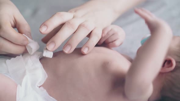 Careful Mother Hands Disinfect Cute Infant Umbilical Cord