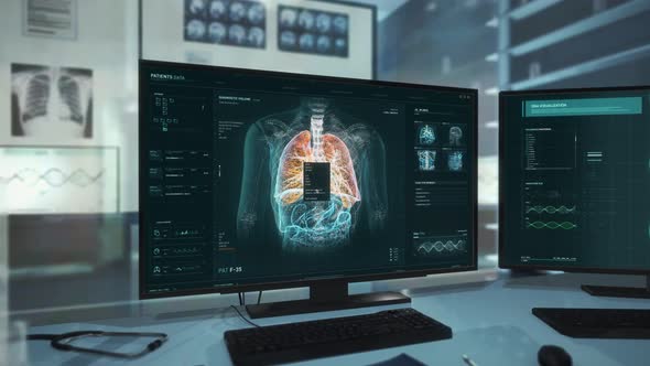 Finding Covid-19 Traces after Investigation of the Human Lungs at medical room alt
