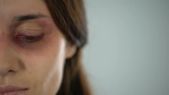 Sad Lady With Bruised Face Looking at Camera, Violence, Gender Discrimination