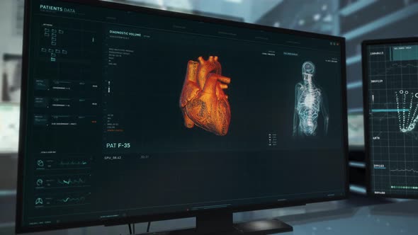 Diagnostic X-Ray Examination Of Patients Heart At Hospital Cardiology Laboratory