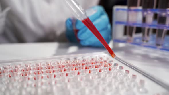 The Doctor Conducts Research, Preparing a Blood Sample for Research on a Microscope.