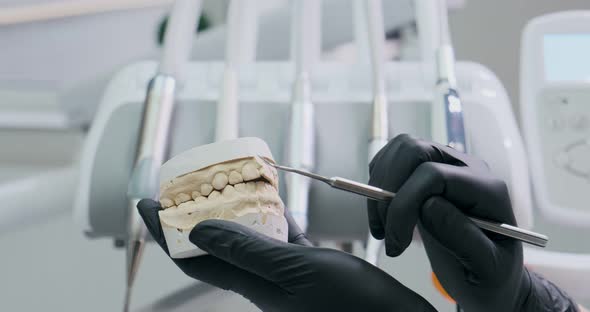 Dentist Shows the Patient on the Model of the Jaw How To Properly Treat Her Teeth, Care of the Teeth