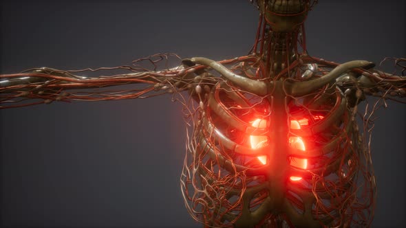 CG Animation Of A Sick Human Heart