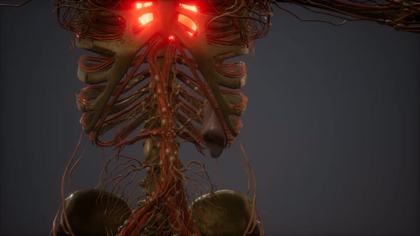CG Animation Of A Sick Human Heart alt