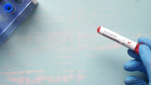 Hand in Blue Medical Gloves Holding Blood Test Tube