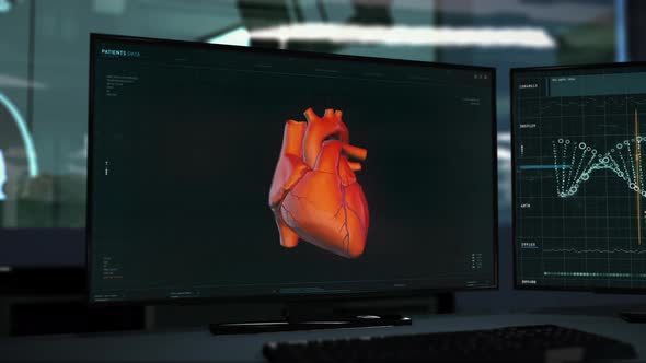 Innovative Medical Analysis Interface Checks Heart Organ Arteries For Illness alt