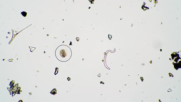 The Nematode is Twisting Near the Perfectly Round Egg of the Other Microorganism