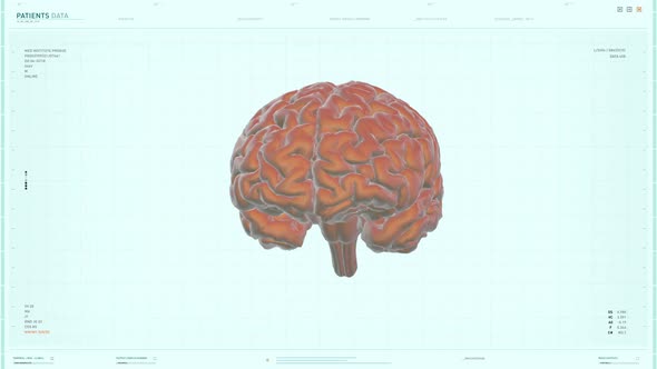 Patients Brain Scanned By High Tech Medical Monitoring System Interface