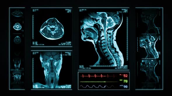 Loopable Neck MRI Scan. Blue. 3 videos in 1. Animation showing top, front, lateral view and ECG.