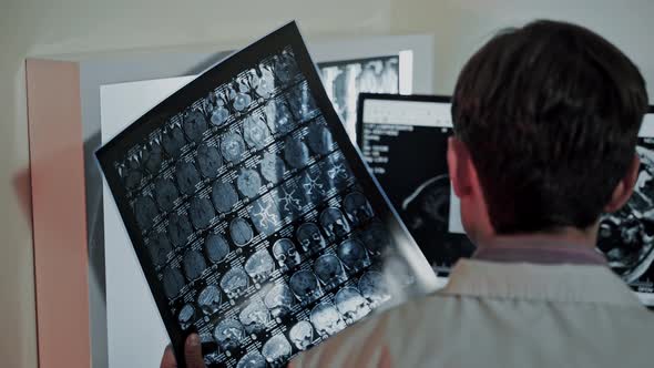 Surgeon Observing Skull Brain Xray Film Analysis