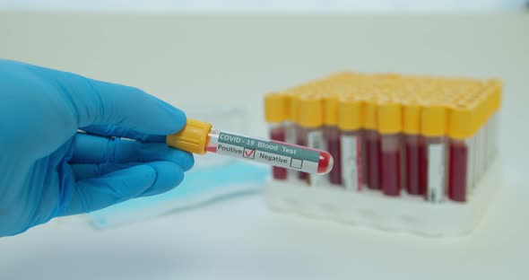 Researcher Hand Showing Tube, Positive Result of Blood Test for Coronavirus, Covid-2.