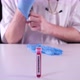 Doctor wearing blue gloves and showing test-tube with positive coronavirus test result - VideoHive Item for Sale