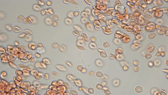 Blood Under a Microscope, the Movement of Red Blood Cells Is Visible