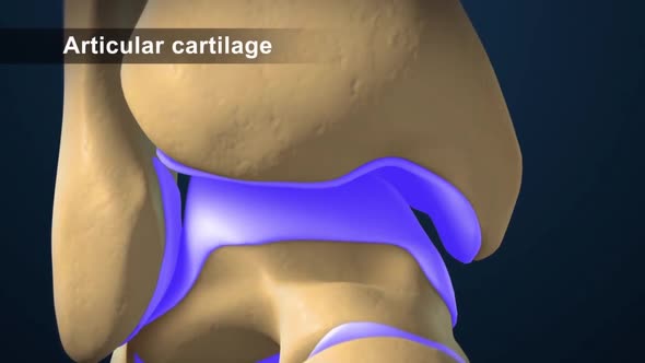 Articular cartilage is the tissue that covers the ends of bones.