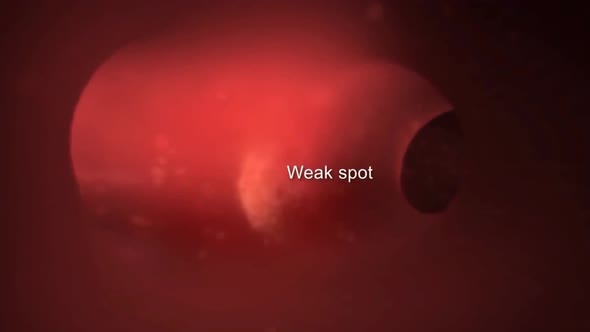 Red blood cells in blood vessels passing through blood circulation