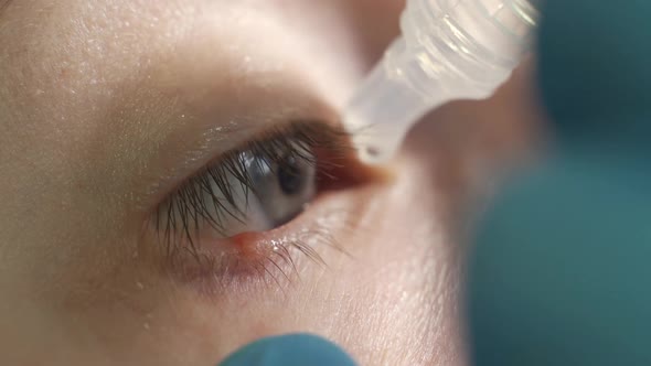 Optometrist Putting Drops Into Patients Eyes in Ophthalmology Clinic