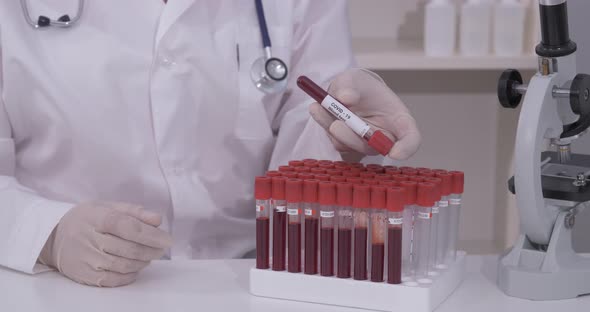 Covid-19 Infected Blood Sample in Vacuum Tube in Hand of Scientist Doctor in Research Laboratory