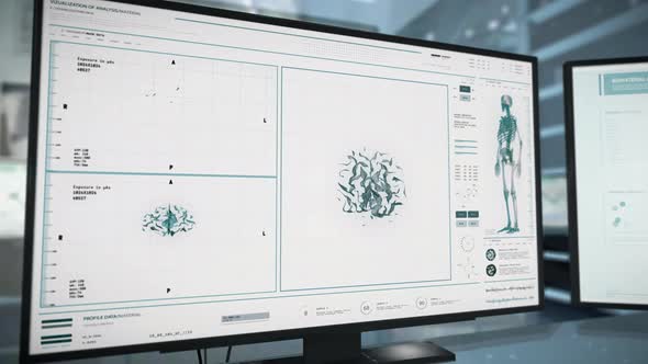Advanced Digital X-ray Diagnostic System Software Analyzes Patients Brain Organ alt