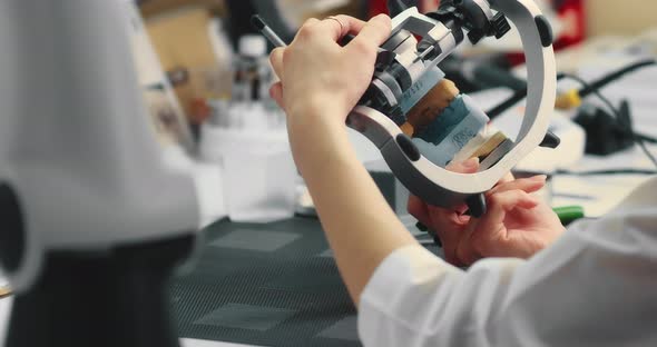 Dental Technician Makes a Plaster Cast of Jaw Models in an Articulator