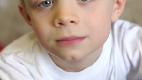 Close up of Allergic Spot on the Little Boy's Neck Allergic Reaction
