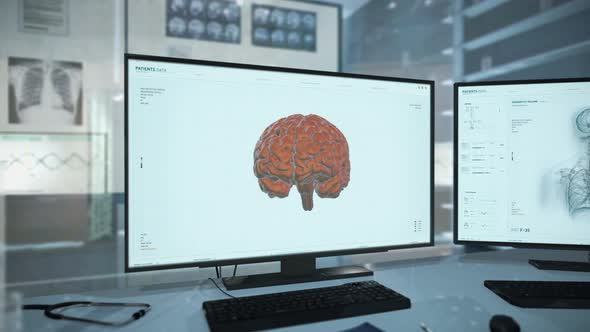 Futuristic disease examination interface detecting cancer growth in a brain alt