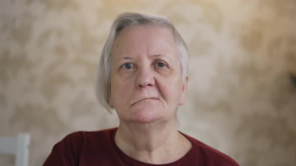 Portrait of a Woman with Facial Paralysis