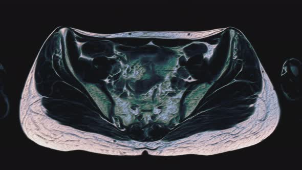 Bulk Multicolored MRI of the Female Pelvic Organs, Abdominal Cavity, Gastrointestinal Tract and