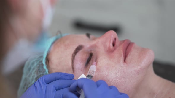 Woman on the Procedure of Mesotherapy Injection with a Syringe