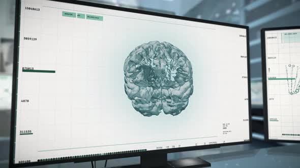 Medical Scan Examination Of Patients Brain Condition At Modern Hospital alt