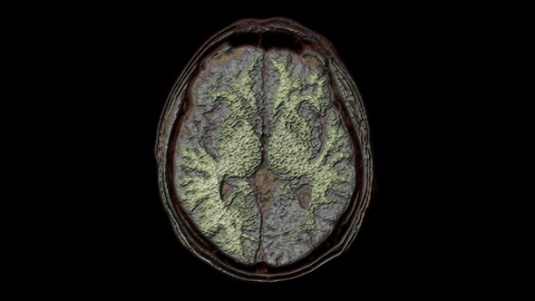 Bulk Multicolored MRI Scans of the Brain and Head To Detect Tumors. Diagnostic Medical Tool