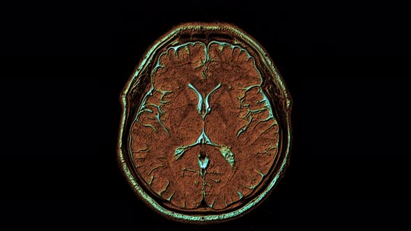 Bulk Multicolored MRI Scans of the Brain and Head To Detect Tumors. Diagnostic Medical Tool