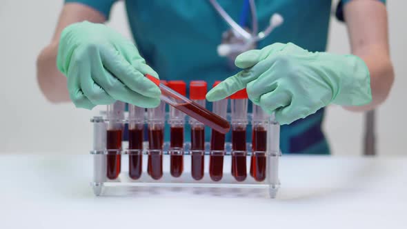 Doctor Nurse Woman Wearing Protective Mask and Latex Gloves - Working with Blood Test Tube Rack