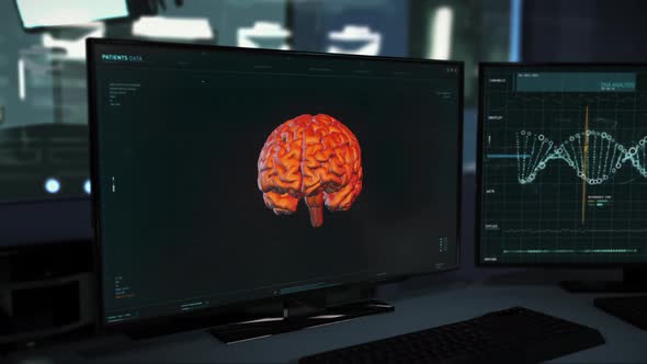 Innovative Medical Scanner Diagnoses Brain Tumor During X-Ray Examination alt