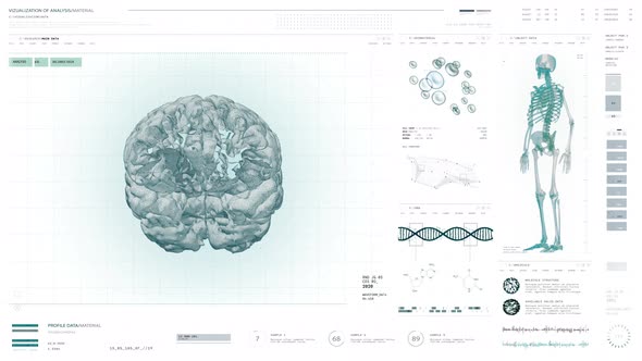 X-ray Diagnosis Of Human Brain By Futuristic Screening Interface Software