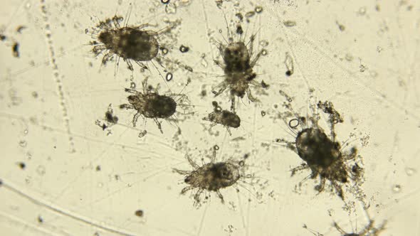 Barn or Flour Mite Under a Microscope