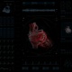 Medical Screen. Cardio 4K - VideoHive Item for Sale