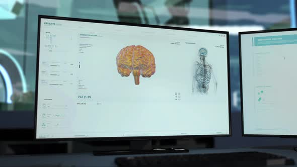 Futuristic Hospital Health Monitoring Interface Scanning Patients Brain alt