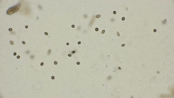 colony of ciliates Coleps  under a microscope